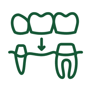 Dental Bridges